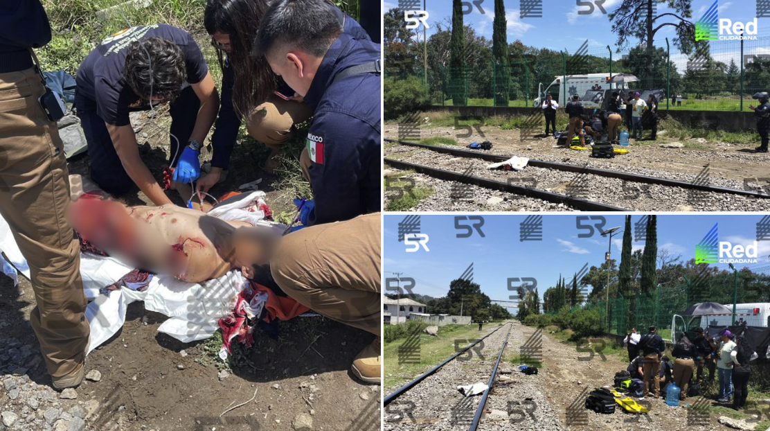 Train Accident in Amalucan: Victim Survives Despite Severe Injuries and Amputations
