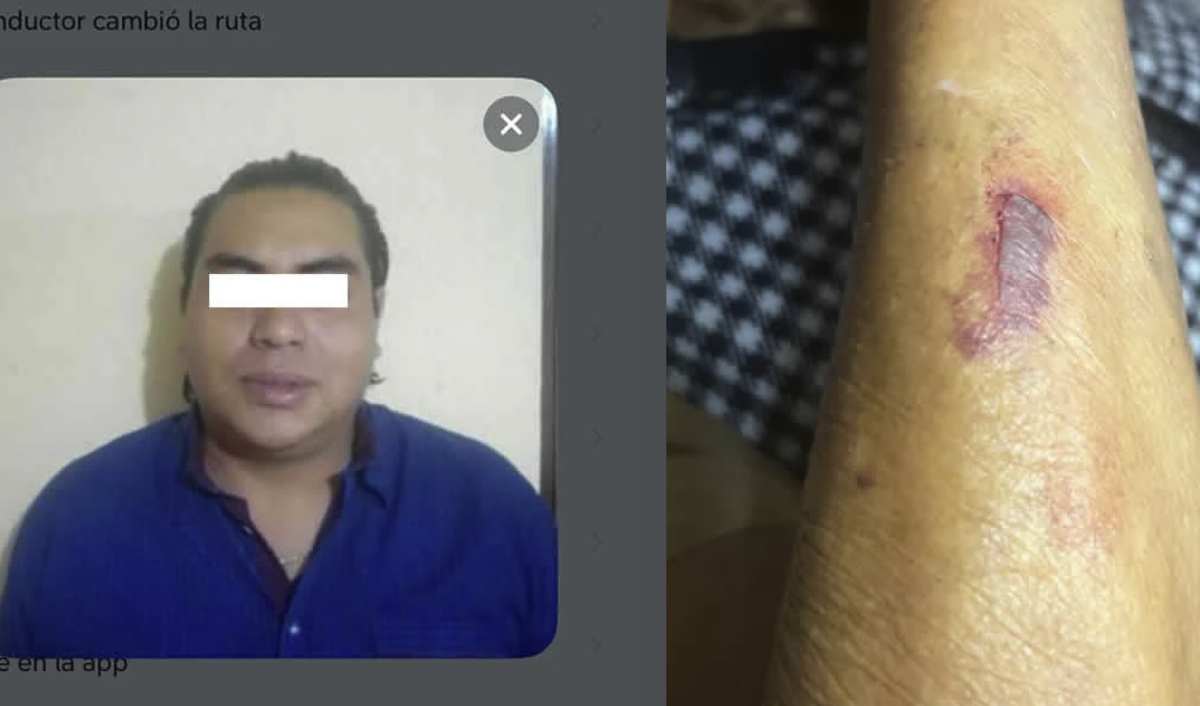 DiDi driver in Puebla forces elderly woman and her children out of car over card payment, leaves visible bruise